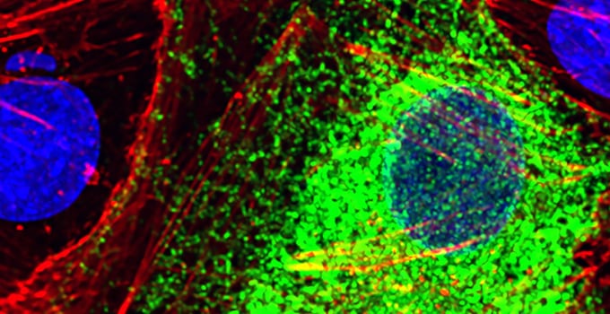 Una inteligencia artificial de Stanford distingue células sanas y enfermas leyendo la actividad de sus genes