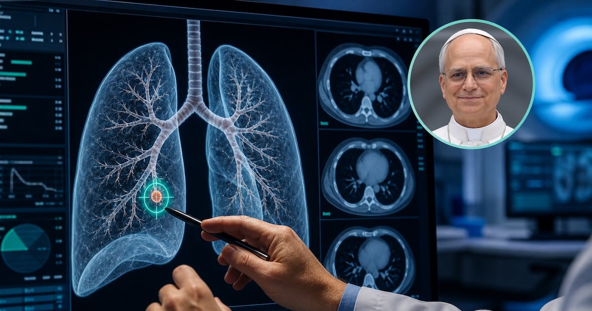 Nódulo pulmonar: por qué un punto de tres milímetros puede terminar en el quirófano